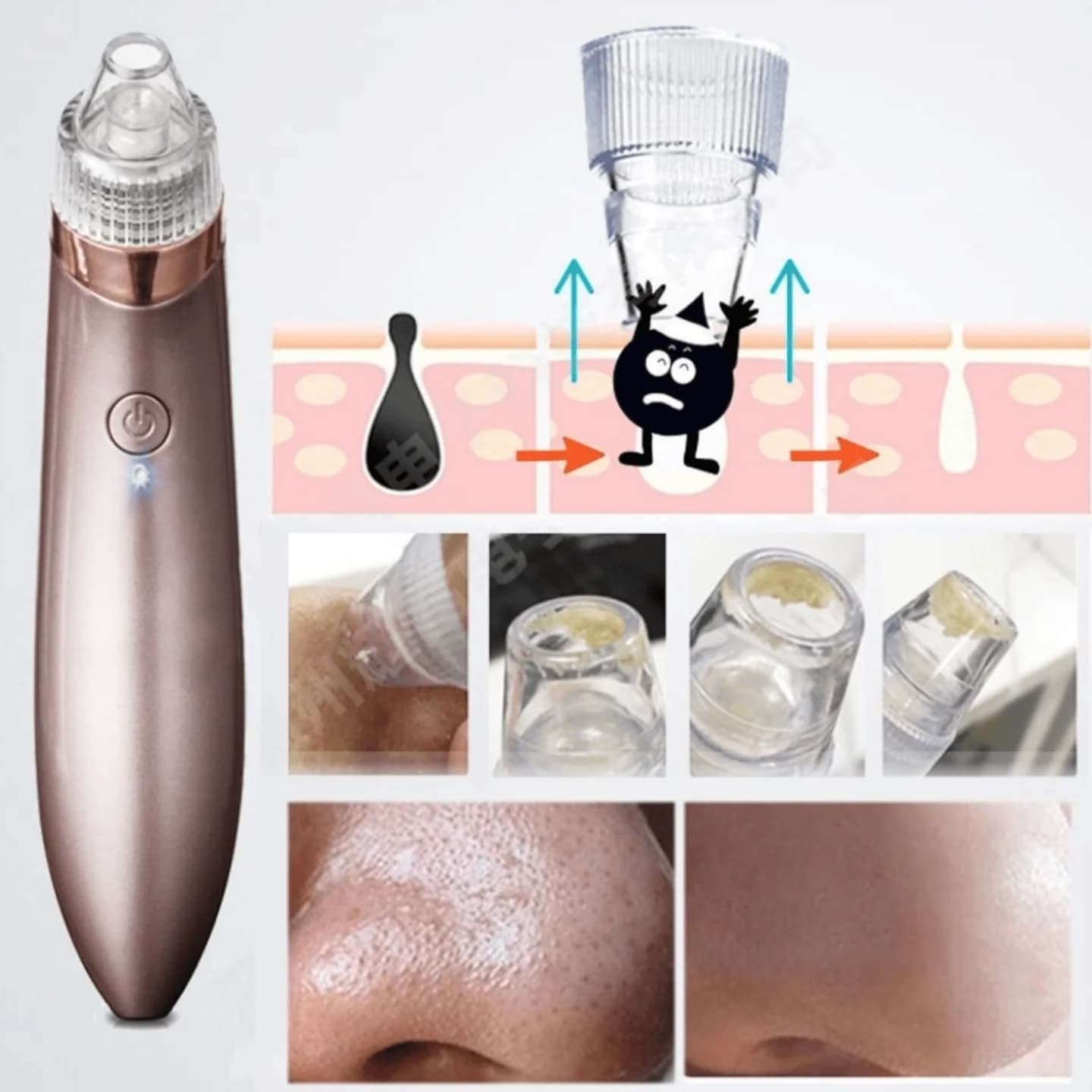 Vakumski uređaj za dubinsko čišćenje pora "RT-8080" 5